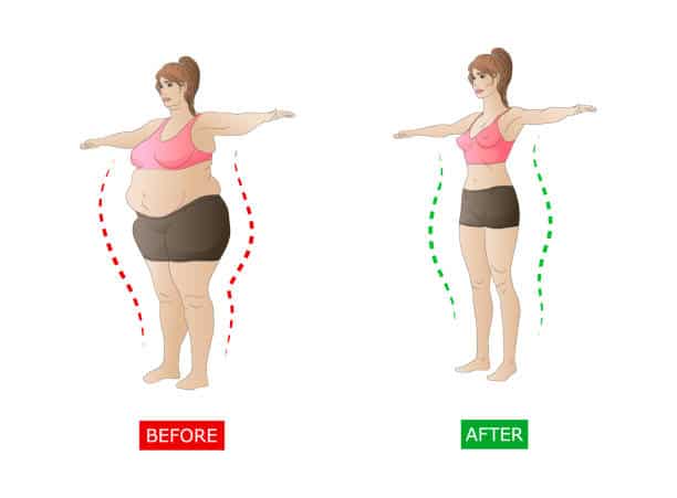 How to Avoid Loose Skin After Weight Loss Surgery