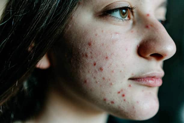 face reality skin care